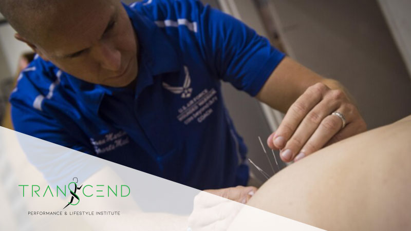 Dr. Sean Martin performing acupuncture on a patient.